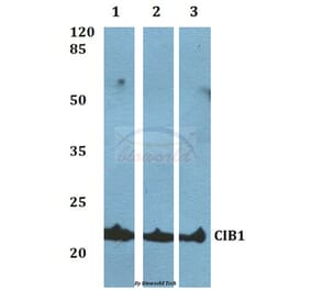 Anti-CIB1 Antibody from Bioworld Technology (BS60061) - Antibodies.com