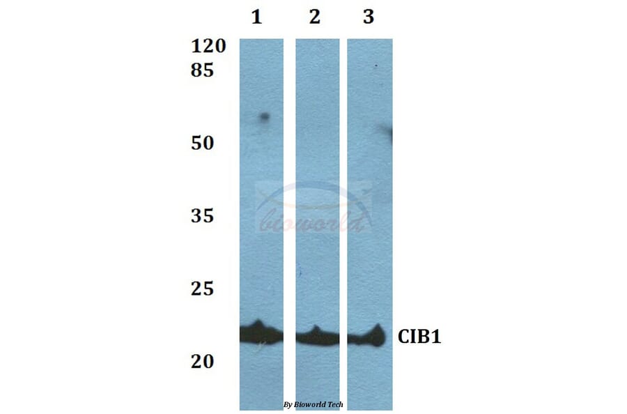 Anti-CIB1 Antibody from Bioworld Technology (BS60061) - Antibodies.com