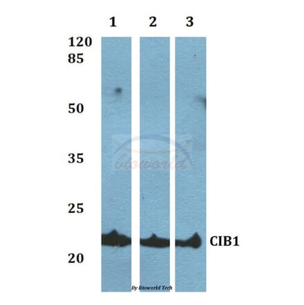 Anti-CIB1 Antibody from Bioworld Technology (BS60061) - Antibodies.com