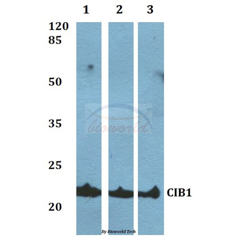 Anti-CIB1 Antibody from Bioworld Technology (BS60061) - Antibodies.com