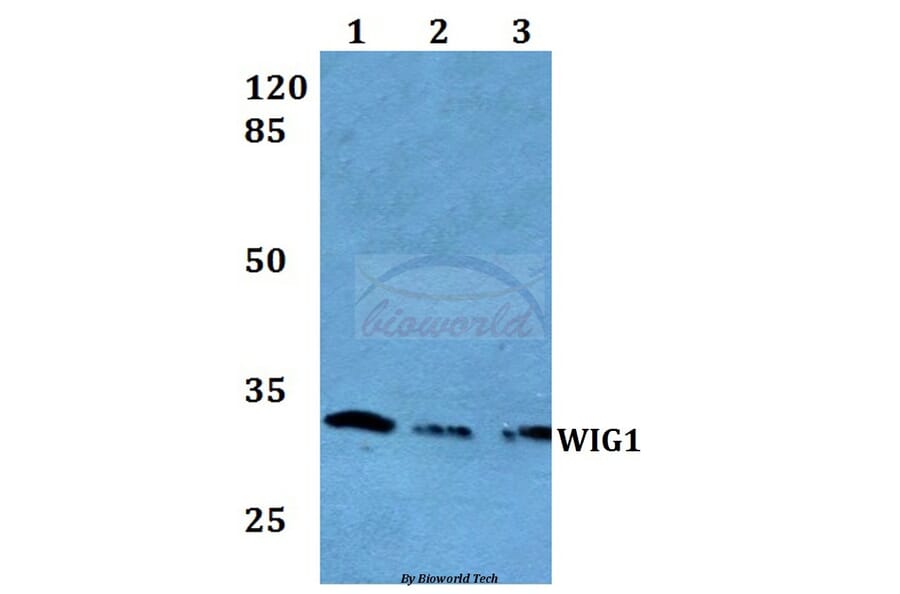 Anti-WIG1 Antibody from Bioworld Technology (BS60063) - Antibodies.com