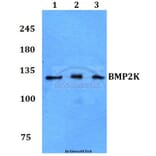 Anti-BMP2K Antibody from Bioworld Technology (BS60064) - Antibodies.com