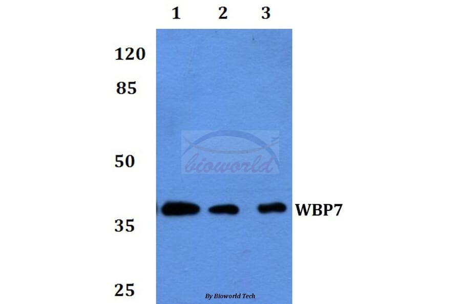 Anti-WBP7 Antibody from Bioworld Technology (BS60066) - Antibodies.com