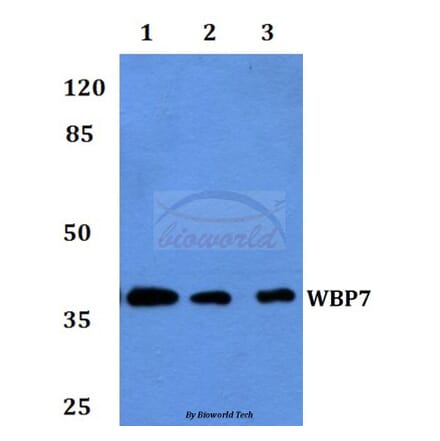 Anti-WBP7 Antibody from Bioworld Technology (BS60066) - Antibodies.com