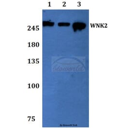 Anti-WNK2 Antibody from Bioworld Technology (BS60069) - Antibodies.com