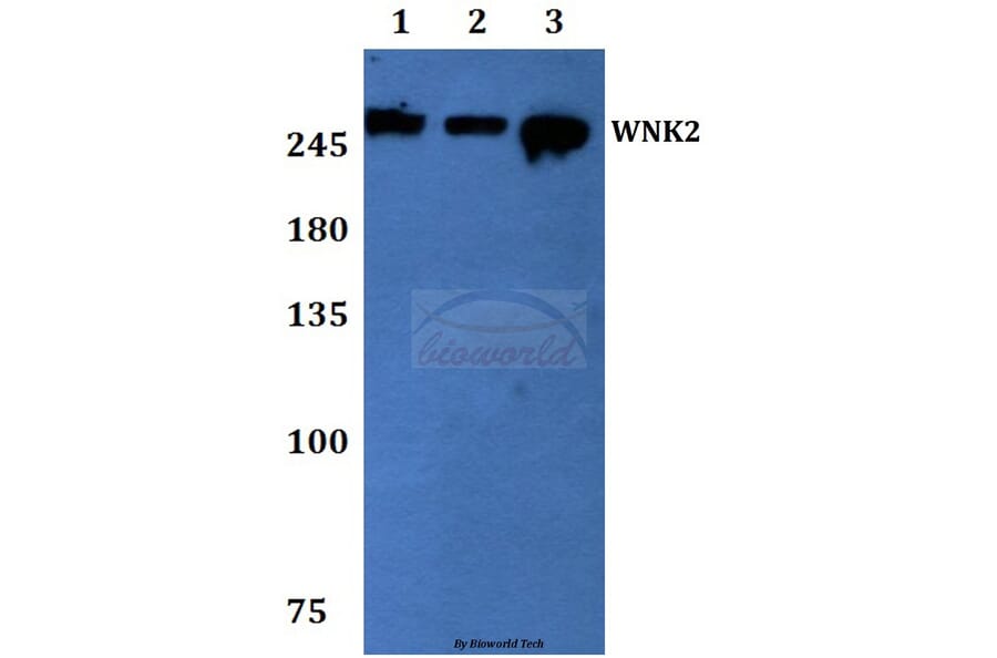 Anti-WNK2 Antibody from Bioworld Technology (BS60069) - Antibodies.com