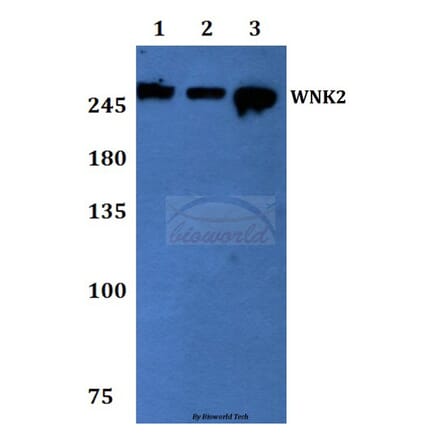 Anti-WNK2 Antibody from Bioworld Technology (BS60069) - Antibodies.com