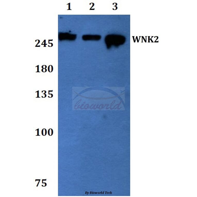 Anti-WNK2 Antibody from Bioworld Technology (BS60069) - Antibodies.com