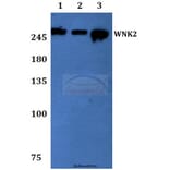 Anti-WNK2 Antibody from Bioworld Technology (BS60069) - Antibodies.com