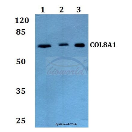 Anti-COL8A1 Antibody from Bioworld Technology (BS60070) - Antibodies.com
