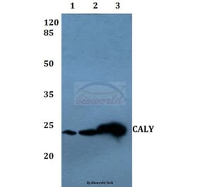 Anti-CALY Antibody from Bioworld Technology (BS60076) - Antibodies.com