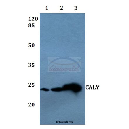 Anti-CALY Antibody from Bioworld Technology (BS60076) - Antibodies.com
