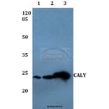 Anti-CALY Antibody from Bioworld Technology (BS60076) - Antibodies.com