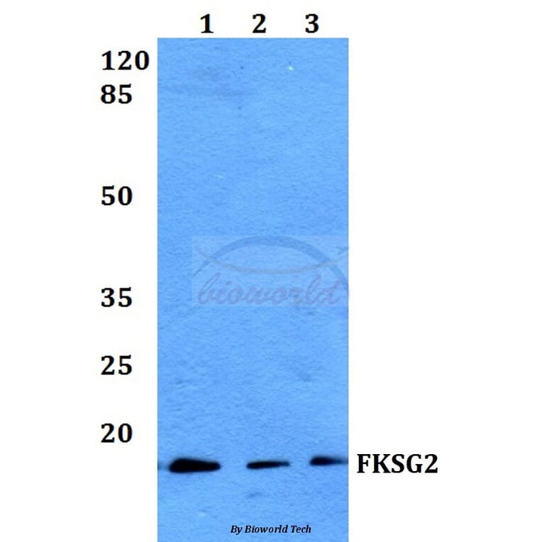 Anti-FKSG2 Antibody from Bioworld Technology (BS60077) - Antibodies.com