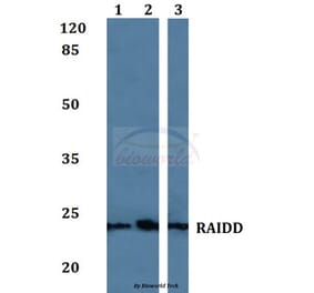 Anti-RAIDD Antibody from Bioworld Technology (BS60078) - Antibodies.com