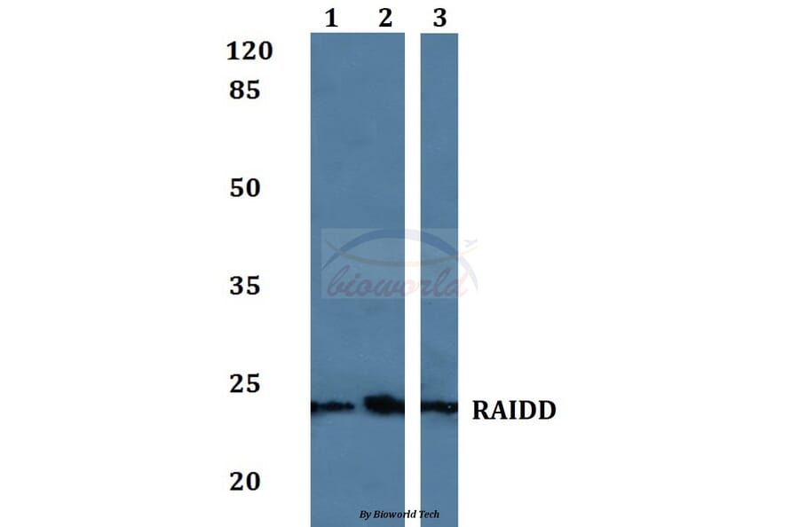 Anti-RAIDD Antibody from Bioworld Technology (BS60078) - Antibodies.com