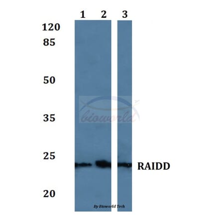 Anti-RAIDD Antibody from Bioworld Technology (BS60078) - Antibodies.com