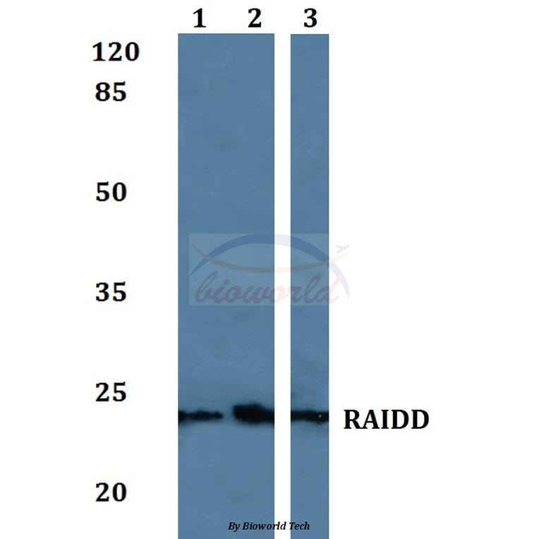 Anti-RAIDD Antibody from Bioworld Technology (BS60078) - Antibodies.com