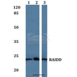 Anti-RAIDD Antibody from Bioworld Technology (BS60078) - Antibodies.com