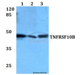 Anti-TNFRSF10B Antibody from Bioworld Technology (BS60081) - Antibodies.com