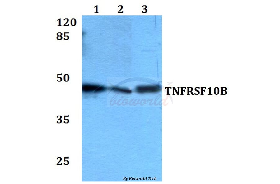 Anti-TNFRSF10B Antibody from Bioworld Technology (BS60081) - Antibodies.com