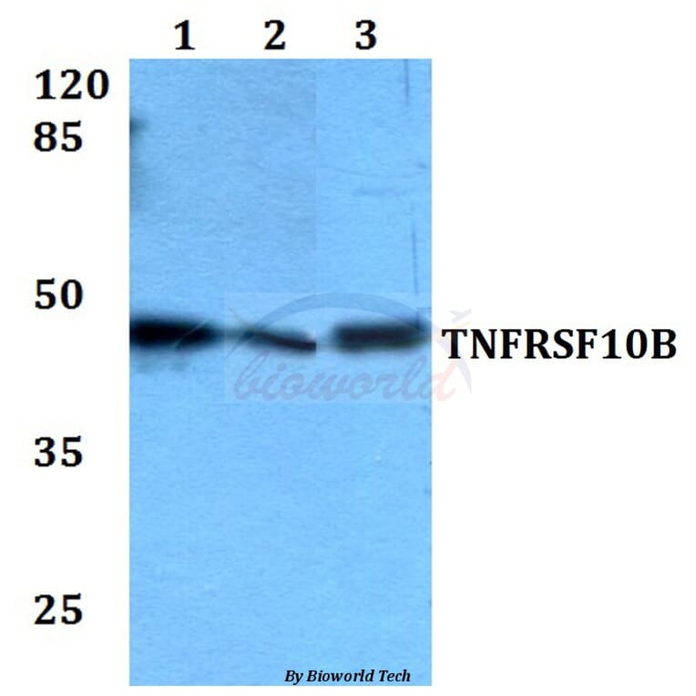 Anti-TNFRSF10B Antibody from Bioworld Technology (BS60081) - Antibodies.com