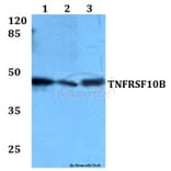 Anti-TNFRSF10B Antibody from Bioworld Technology (BS60081) - Antibodies.com