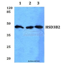 Anti-HSD3B2 Antibody from Bioworld Technology (BS60084) - Antibodies.com