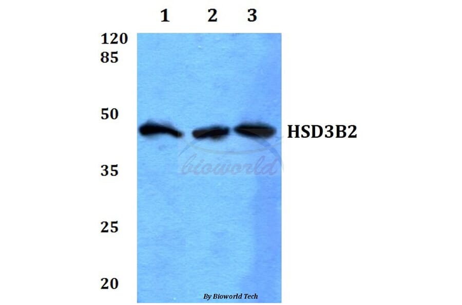 Anti-HSD3B2 Antibody from Bioworld Technology (BS60084) - Antibodies.com