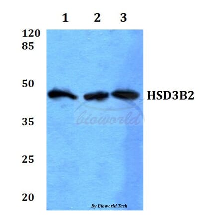 Anti-HSD3B2 Antibody from Bioworld Technology (BS60084) - Antibodies.com