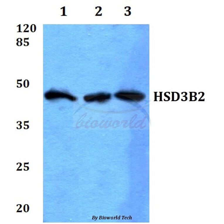 Anti-HSD3B2 Antibody from Bioworld Technology (BS60084) - Antibodies.com