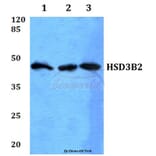 Anti-HSD3B2 Antibody from Bioworld Technology (BS60084) - Antibodies.com
