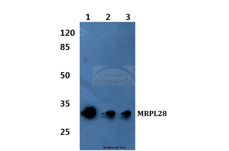 Anti-MRP-L28 Antibody from Bioworld Technology (BS60085) - Antibodies.com