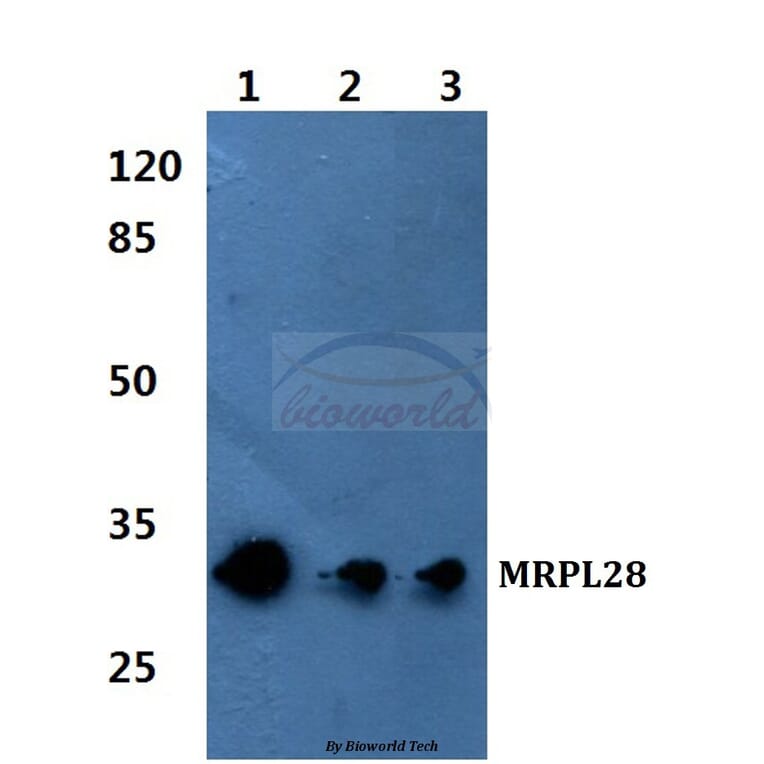 Anti-MRP-L28 Antibody from Bioworld Technology (BS60085) - Antibodies.com