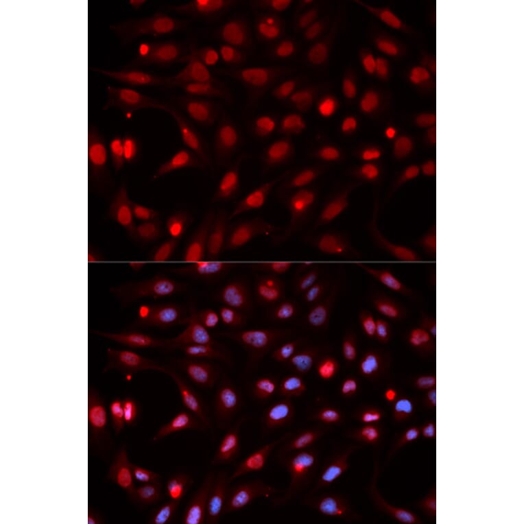Anti-APEX1 Antibody from Bioworld Technology (BS6009) - Antibodies.com