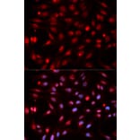 Anti-APEX1 Antibody from Bioworld Technology (BS6009) - Antibodies.com