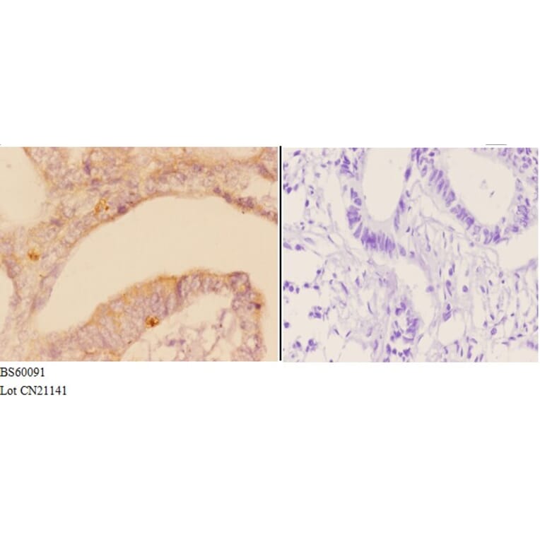 Anti-ADAM23 Antibody from Bioworld Technology (BS60091) - Antibodies.com
