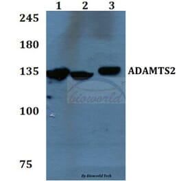 Anti-ADAMTS2 Antibody from Bioworld Technology (BS60092) - Antibodies.com