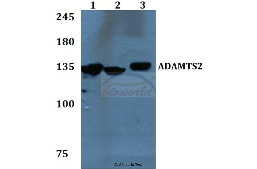 Anti-ADAMTS2 Antibody from Bioworld Technology (BS60092) - Antibodies.com