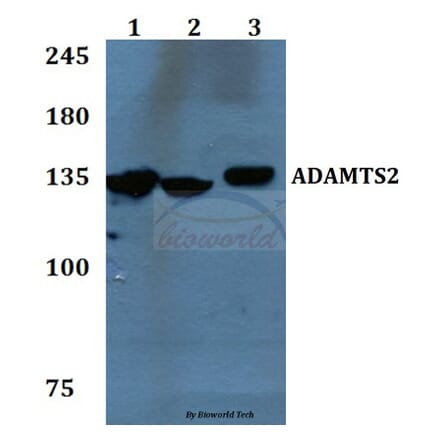 Anti-ADAMTS2 Antibody from Bioworld Technology (BS60092) - Antibodies.com