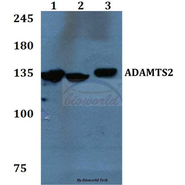 Anti-ADAMTS2 Antibody from Bioworld Technology (BS60092) - Antibodies.com