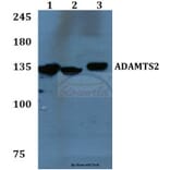 Anti-ADAMTS2 Antibody from Bioworld Technology (BS60092) - Antibodies.com