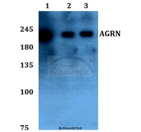 Anti-AGRN Antibody from Bioworld Technology (BS60094) - Antibodies.com
