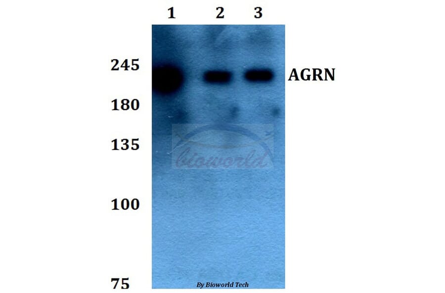 Anti-AGRN Antibody from Bioworld Technology (BS60094) - Antibodies.com