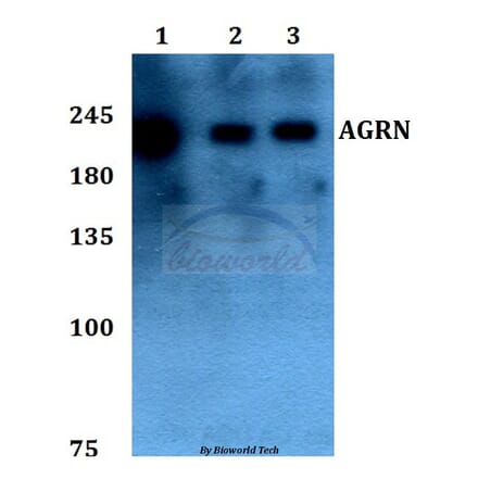 Anti-AGRN Antibody from Bioworld Technology (BS60094) - Antibodies.com