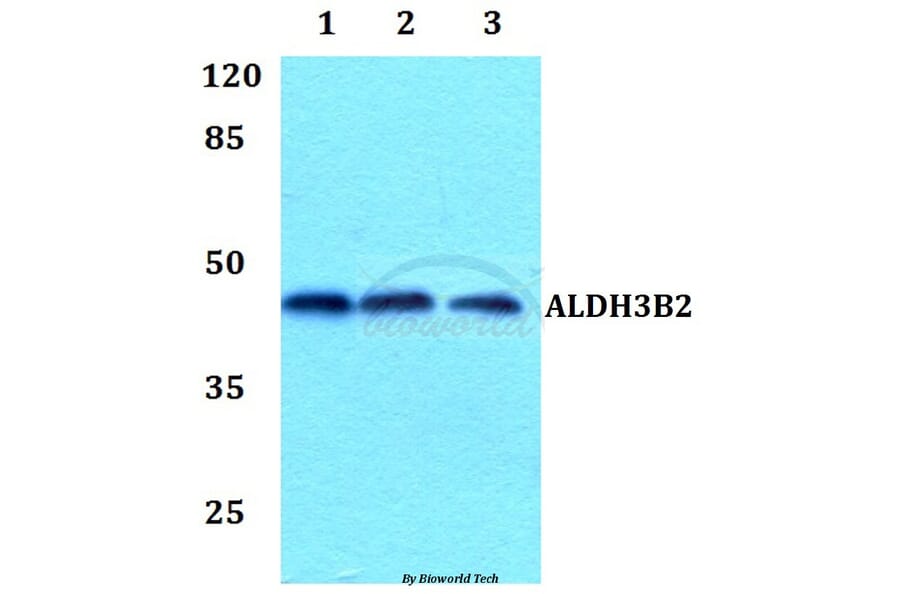 Anti-ALDH3B2 Antibody from Bioworld Technology (BS60095) - Antibodies.com