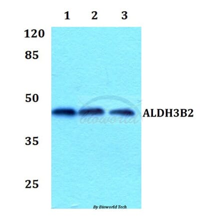 Anti-ALDH3B2 Antibody from Bioworld Technology (BS60095) - Antibodies.com