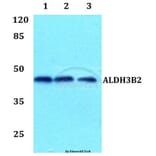 Anti-ALDH3B2 Antibody from Bioworld Technology (BS60095) - Antibodies.com