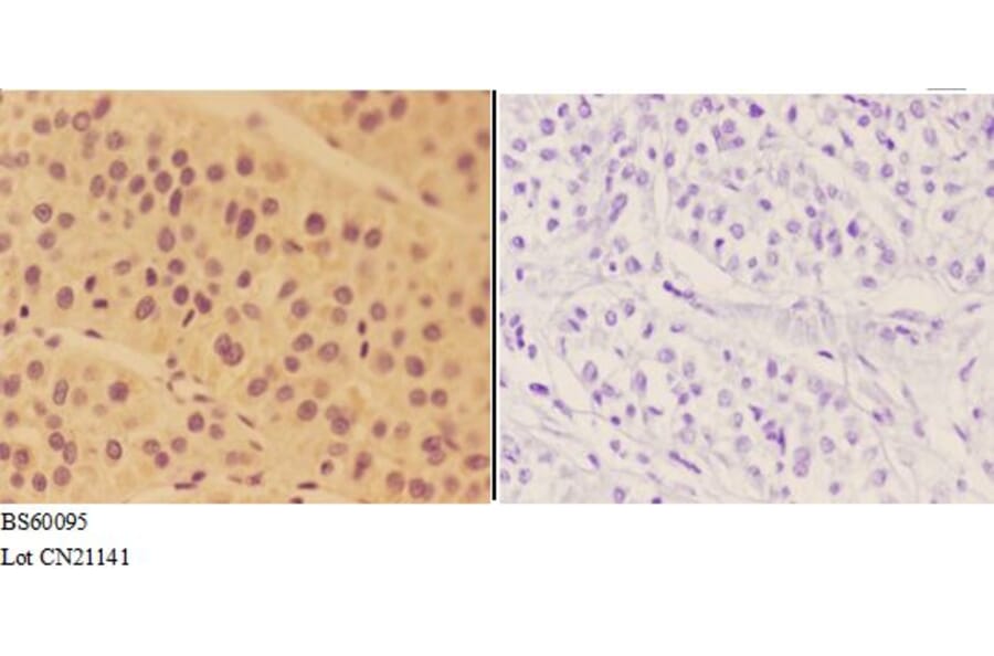 Anti-ALDH3B2 Antibody from Bioworld Technology (BS60095) - Antibodies.com
