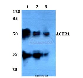 Anti-ACER1 Antibody from Bioworld Technology (BS60096) - Antibodies.com
